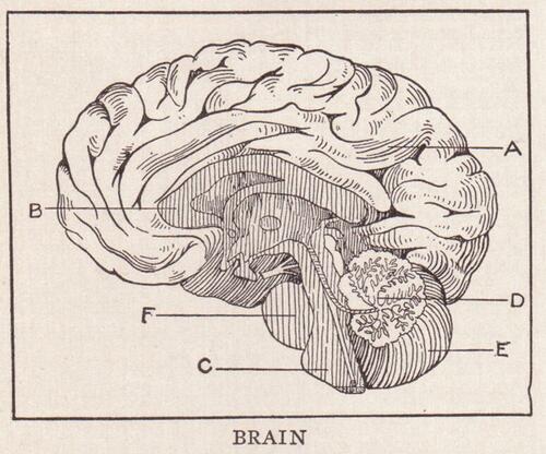 Alzheimer's Could Be A White Matter Disease, Not Gray