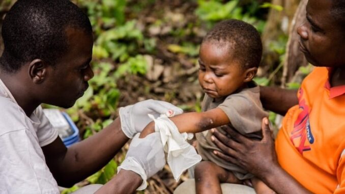 WHO Approves Bill Gates’ Experimental Mpox Jab for Millions of Babies in Africa